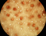 ベニスナゴ　表面観顕微鏡写真