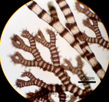ハリイギス　枝顕微鏡写真