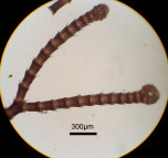 トゲイギス　枝顕微鏡写真