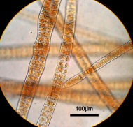 ウシケノリ　顕微鏡写真１
