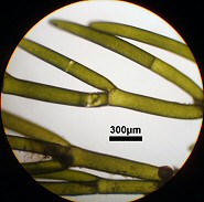 アサミドリシオグサ　顕微鏡写真