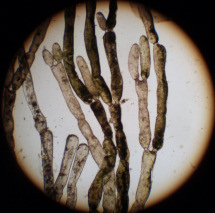 イトゲノマユハキ　顕微鏡写真