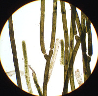マユハキモ　顕微鏡写真