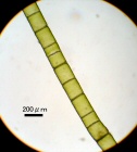 ウスイロジュズモ　顕微鏡写真